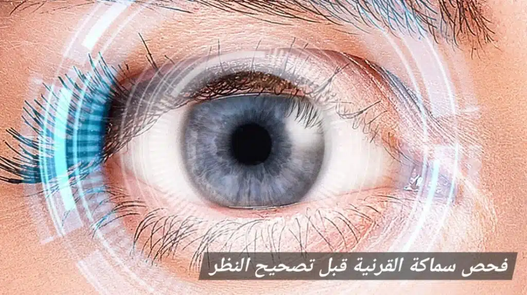 فحص سماكة القرنية قبل تصحيح النظر
