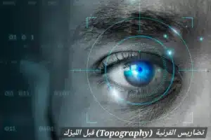 1000439989 المدونة