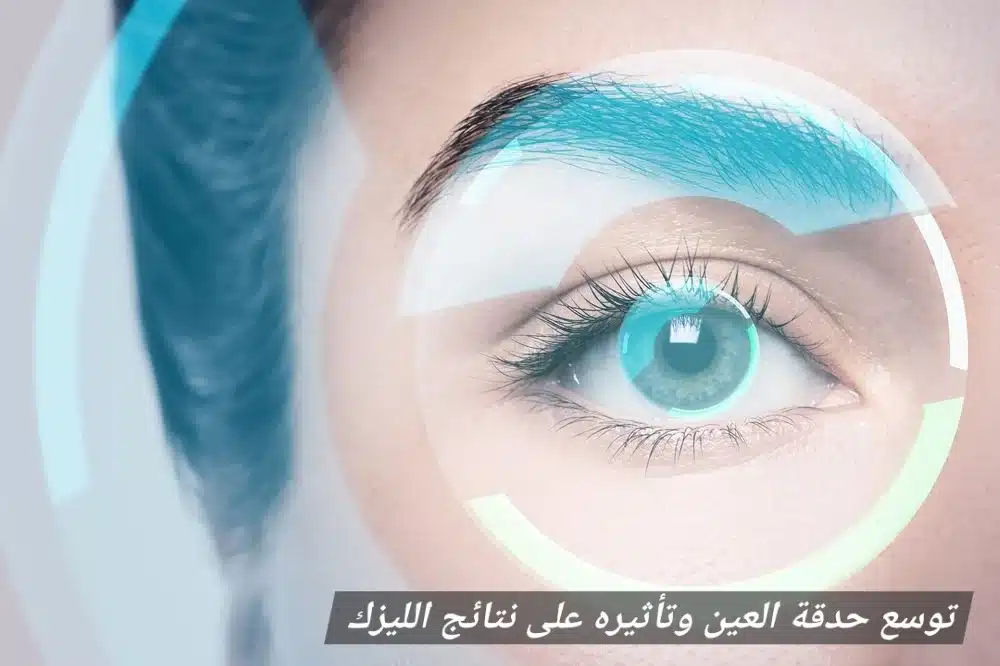 توسع حدقة العين وتأثيره على نتائج الليزك
