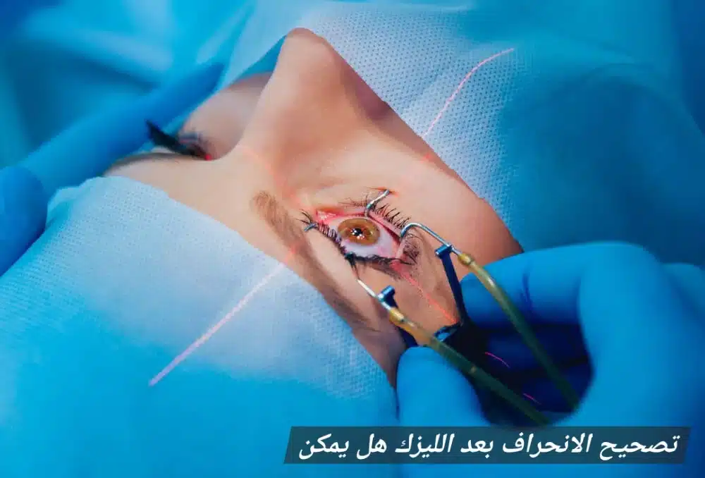 تصحيح الانحراف بعد الليزك هل يمكن

