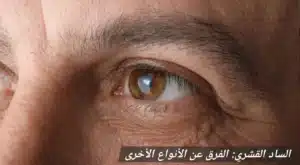 المدونة 3 1000446142 المدونة
