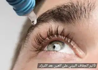 تأثير الجفاف البيئي على العين بعد الليزك
