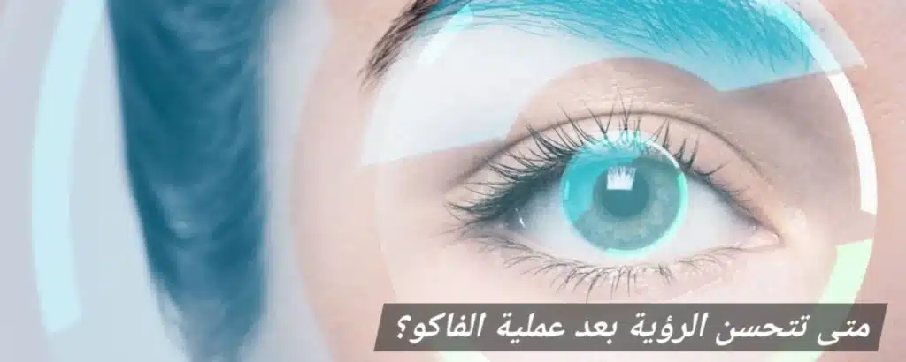 متى تتحسن الرؤية بعد عملية الفاكو 1 1000450411 متى تتحسن الرؤية بعد عملية الفاكو