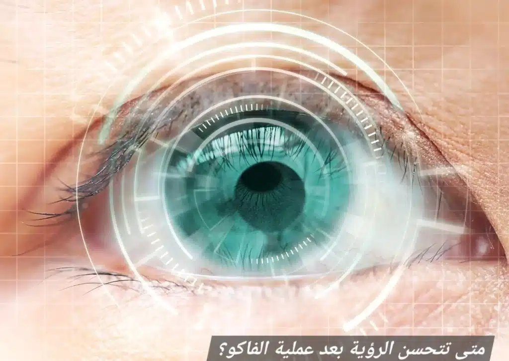 متى تتحسن الرؤية بعد عملية الفاكو 3 متى تتحسن الرؤية بعد عملية الفاكو؟