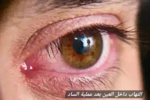 المدونة 2 1000452061 المدونة