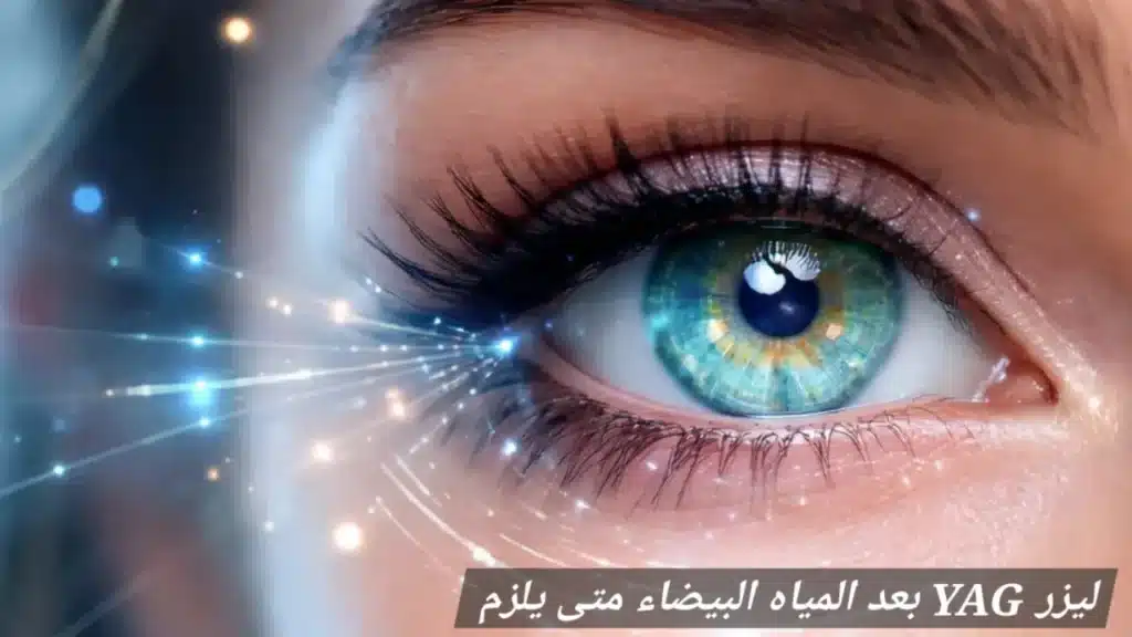 ليزر YAG بعد المياه البيضاء متى يلزم 2 1000452898 ليزر YAG بعد المياه البيضاء متى يلزم