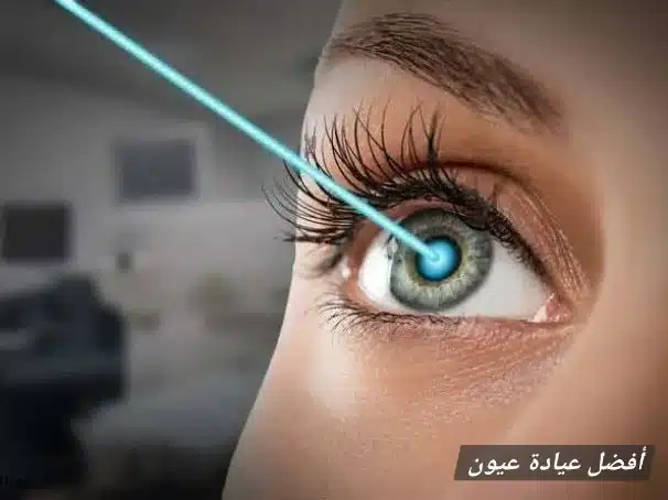 أفضل عيادة عيون