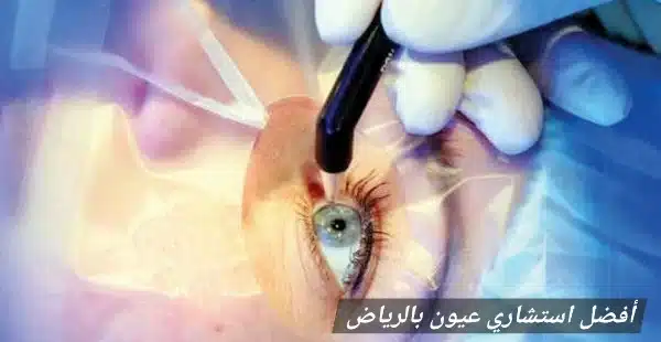 أفضل استشاري عيون بالرياض 2 1000455117 أفضل استشاري عيون بالرياض