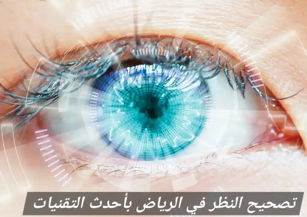 تصحيح النظر في الرياض بأحدث التقنيات 2 تصحيح النظر في الرياض بأحدث التقنيات