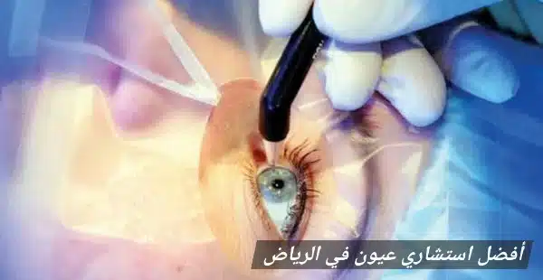 أفضل استشاري عيون في الرياض 3 أفضل استشاري عيون في الرياض