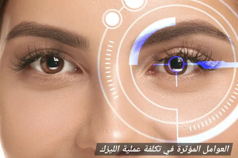 1000460948 1 العوامل المؤثرة في تكلفة عملية الليزك
