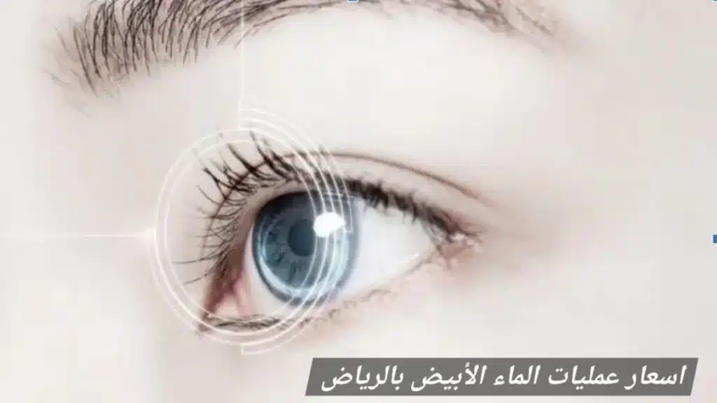 1000463241 اسعار عمليات الماء الأبيض بالرياض
