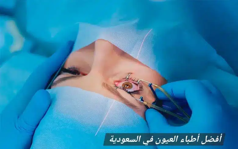 1000464090 أفضل أطباء العيون في السعودية