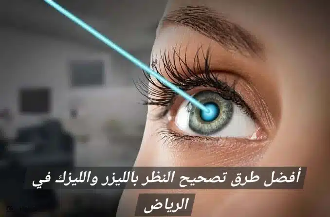 1000466428 أفضل طرق تصحيح النظر بالليزر والليزك في الرياض
