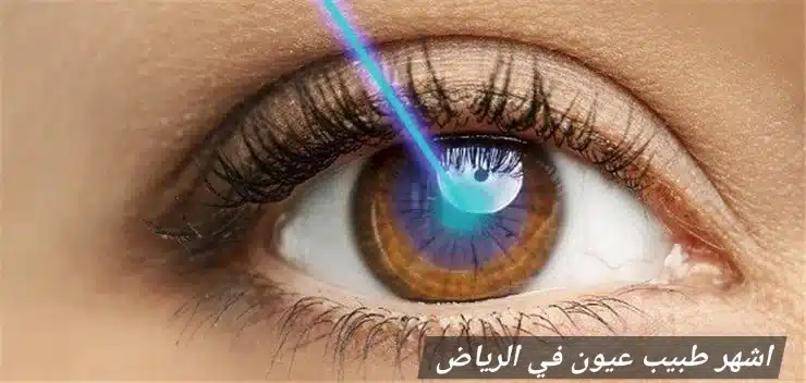 1000470092 اشهر طبيب عيون في الرياض