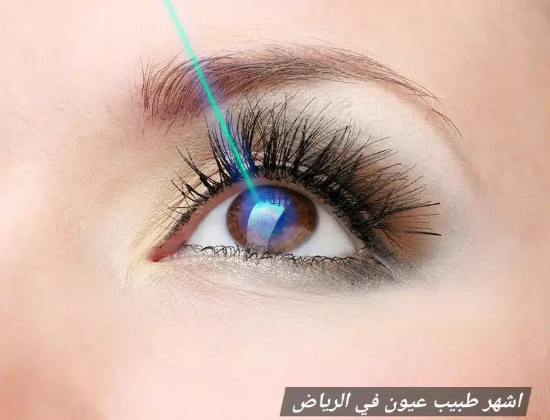 1000470093 اشهر طبيب عيون في الرياض