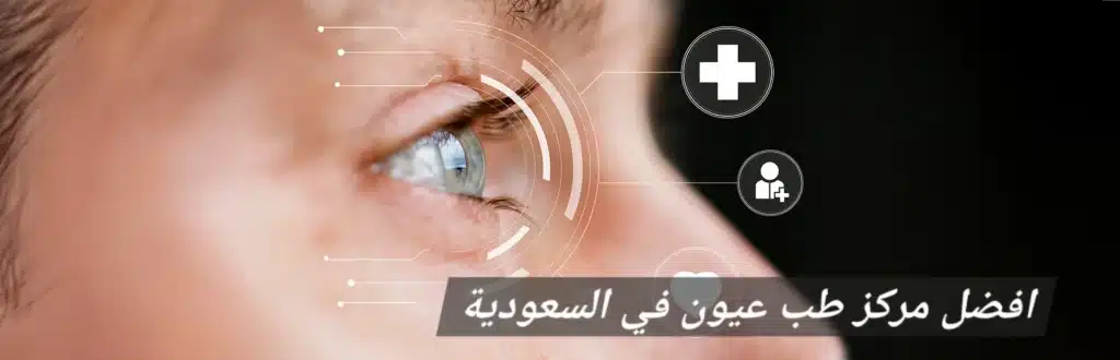 1000474041 افضل مركز طب عيون في السعودية