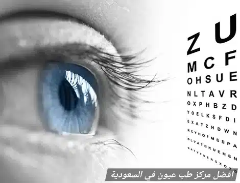 ما افضل مركز طب عيون في السعودية؟
