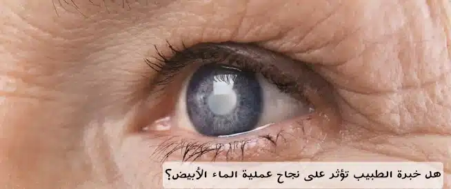 1000478114 هل خبرة الطبيب تؤثر على نجاح عملية الماء الأبيض؟