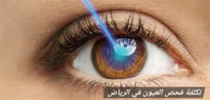 المدونة 3 تكلفة فحص العيون في الرياض