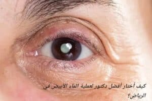 المدونة 2 كيف أختار أفضل دكتور لعملية الماء الأبيض في الرياض؟
