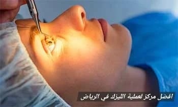 image 5 افضل مركز لعملية الليزك في الرياض