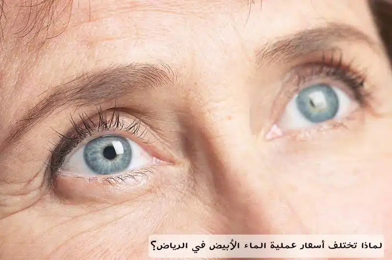 1000485841 لماذا تختلف أسعار عملية الماء الأبيض في الرياض؟