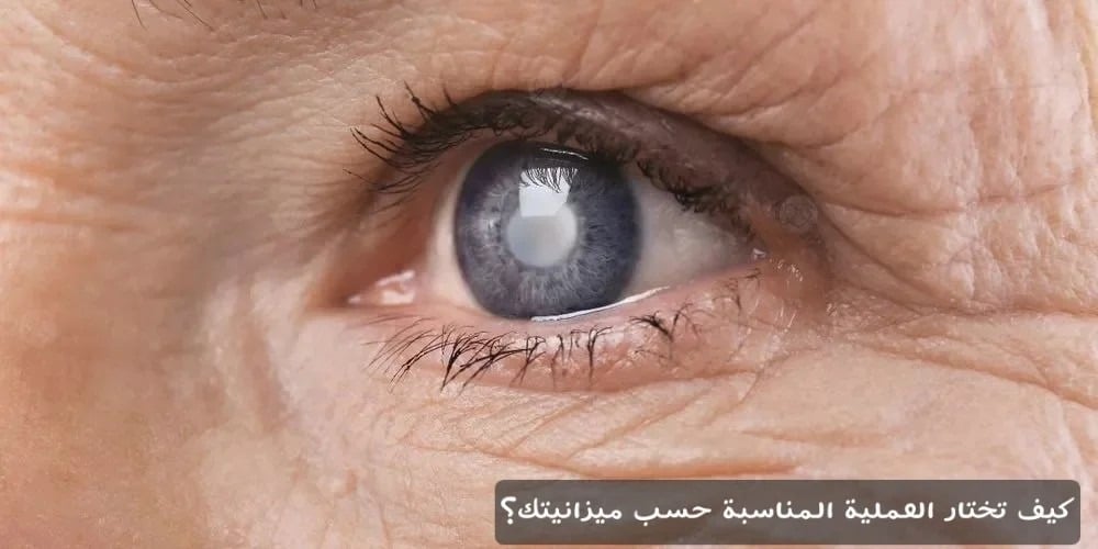 كيف تختار العملية المناسبة حسب ميزانيتك؟ 3 image 13 كيف تختار العملية المناسبة حسب ميزانيتك؟