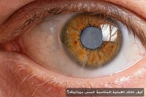 المدونة 1 كيف تختار العملية المناسبة حسب ميزانيتك؟
