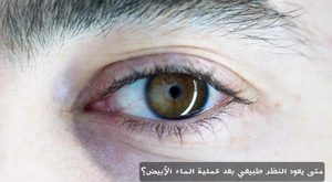 المدونة 4 متى يعود النظر طبيعي بعد عملية الماء الأبيض؟