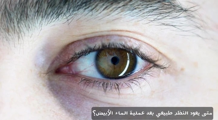 image 16 متى يعود النظر طبيعي بعد عملية الماء الأبيض؟