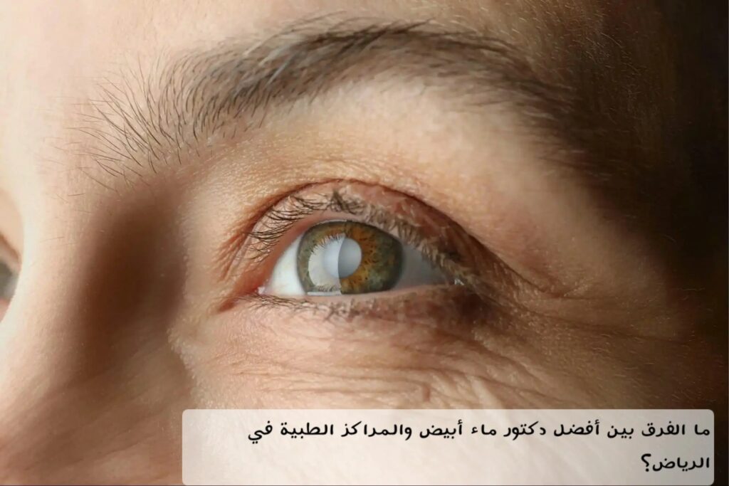 ما الفرق بين أفضل دكتور ماء أبيض والمراكز الطبية في الرياض؟ 2 image 3 ما الفرق بين أفضل دكتور ماء أبيض والمراكز الطبية في الرياض؟