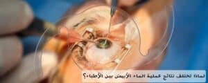 لماذا تختلف نتائج عملية الماء الأبيض بين الأطباء؟