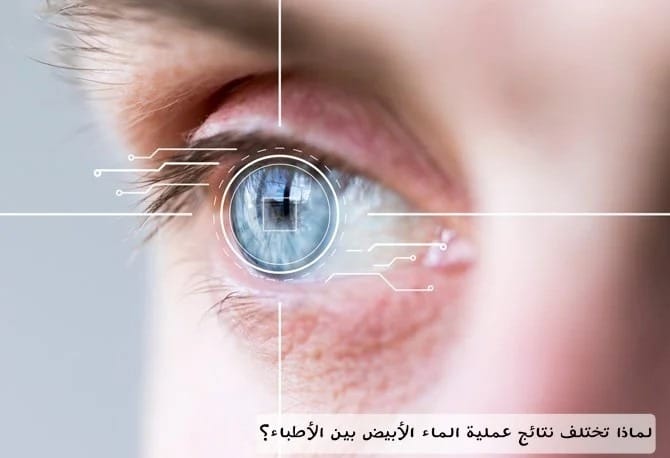 لماذا تختلف نتائج عملية الماء الأبيض بين الأطباء؟ 3 لماذا تختلف نتائج عملية الماء الأبيض بين الأطباء؟