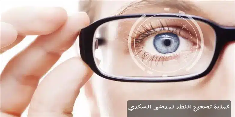عملية تصحيح النظر لمرضى السكري 1 عملية تصحيح النظر لمرضى السكري