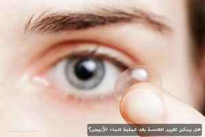 المدونة 2 هل يمكن تغيير العدسة بعد عملية الماء الأبيض؟