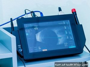 المدونة 3 فحص سماكة القرنية قبل الليزك