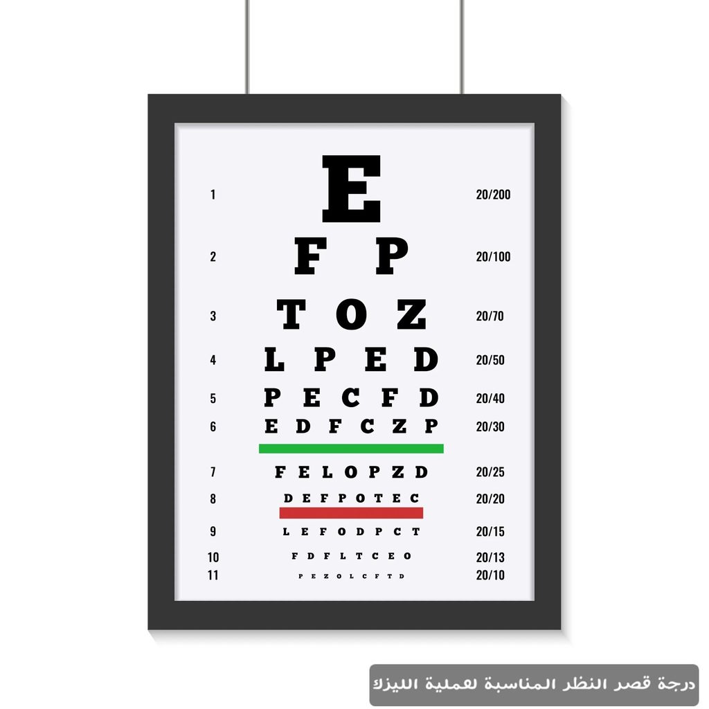 درجة قصر النظر المناسبة لعملية الليزك 1 درجة قصر النظر المناسبة لعملية الليزك