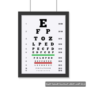 درجة قصر النظر المناسبة لعملية الليزك