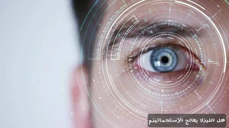 هل الليزك يعالج الاستجماتيزم 3 هل الليزك يعالج الاستجماتيزم