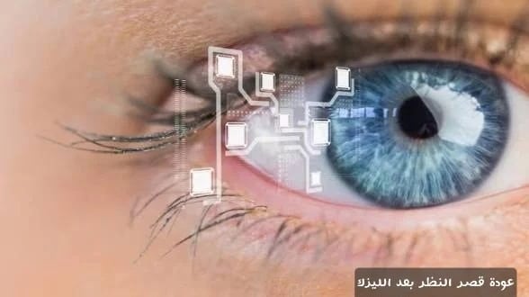 عودة قصر النظر بعد الليزك 1 عودة قصر النظر بعد الليزك
