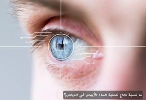 ما نسبة نجاح عملية الماء الأبيض في الرياض؟