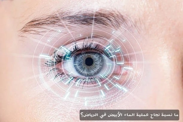 ما نسبة نجاح عملية الماء الأبيض في الرياض؟ 2 image 7 ما نسبة نجاح عملية الماء الأبيض في الرياض؟