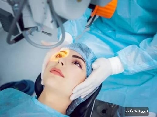 ليزر الشبكية 2 image 13 ليزر الشبكية