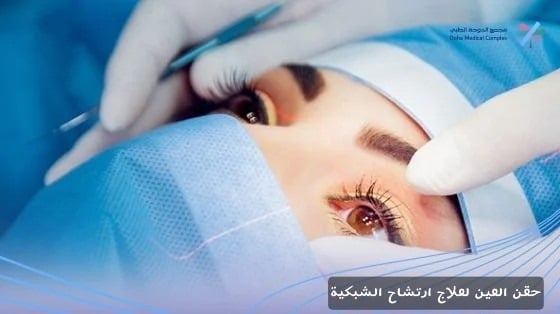 حقن العين لعلاج ارتشاح الشبكية 3 image 9 حقن العين لعلاج ارتشاح الشبكية